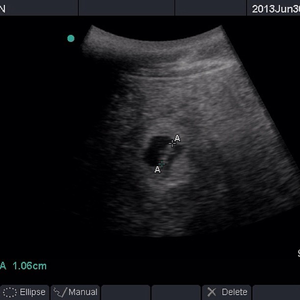 Ultrasound showing panda cubs from June 30